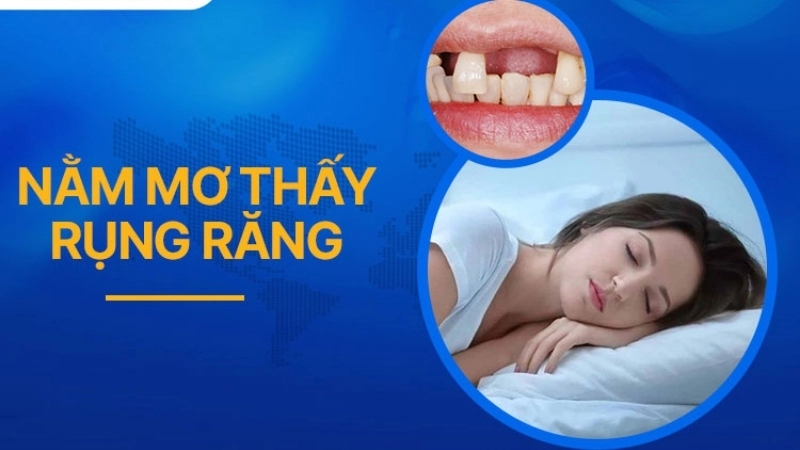 Nằm mơ thấy rụng răng báo trước điều gì về sức khỏe?