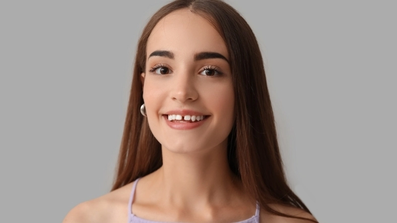 Tướng người răng thưa tốt hay xấu? Vận mệnh ra sao?