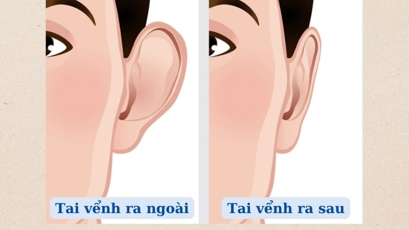 Tướng tai phụ nữ tai vểnh và tai dài