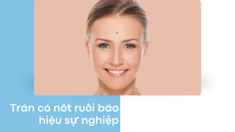 Nốt ruồi trên trán nói gì về công danh